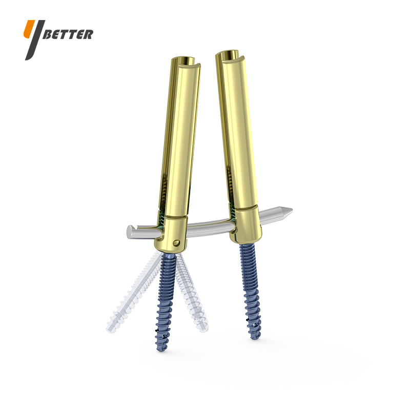 骨水泥微創(chuàng)釘