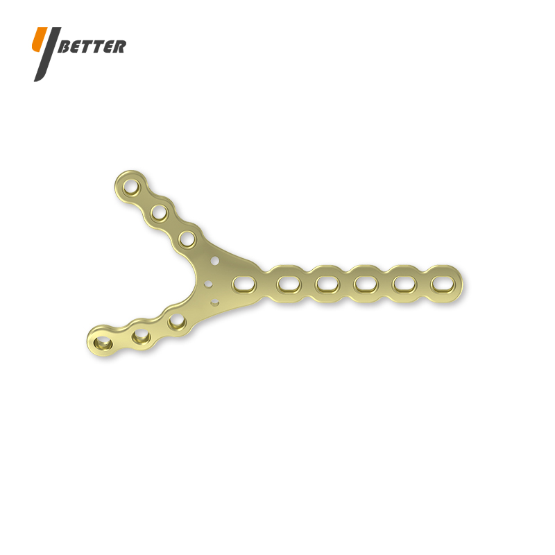 肱骨遠(yuǎn)端Y形接骨板