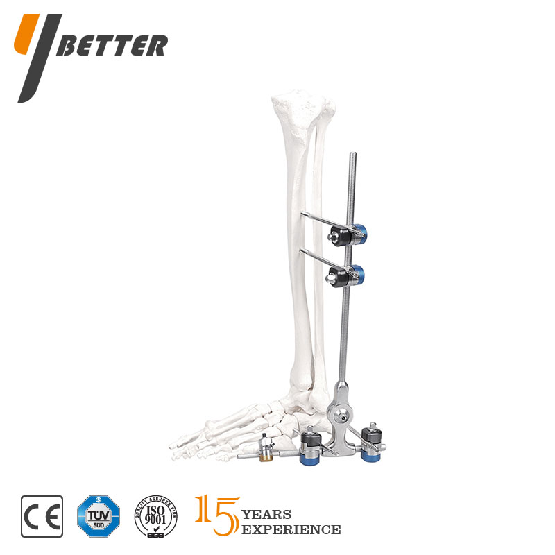 踝關(guān)節(jié)